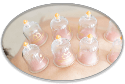 Schröpfen,Frauenheilkunde, Kinderheilkunde, Psychologische Beratung, Therapeutische Frauenmassage, Kinderwunsch, Klassische Homöopathie, Darmsanierung mit Laborstuhldiagnostik, Breuss-Massage